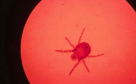 No, You Shouldn’t Use Nail Polish to Treat Chigger Bites