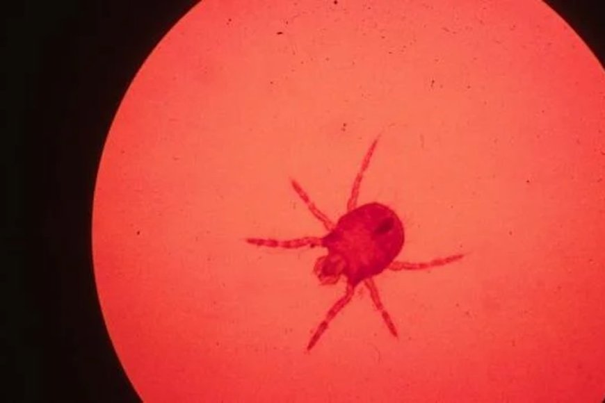No, You Shouldn’t Use Nail Polish to Treat Chigger Bites