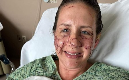 Victim Opens up About ‘Vicious and Relentless’ Otter Attack