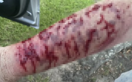 Texas Woman Attacked by Snake and Then a Hawk