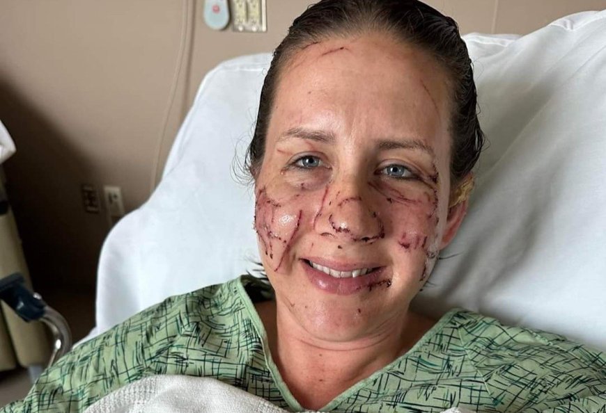 Victim Opens up About ‘Vicious and Relentless’ Otter Attack