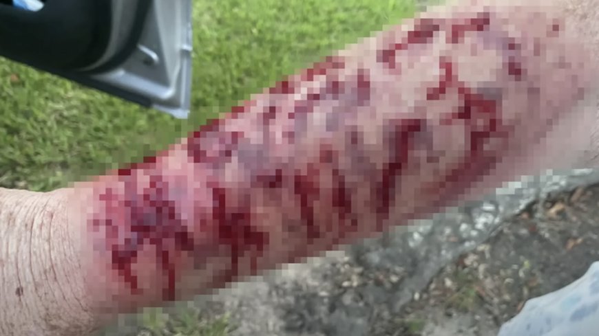 Texas Woman Attacked by Snake and Then a Hawk